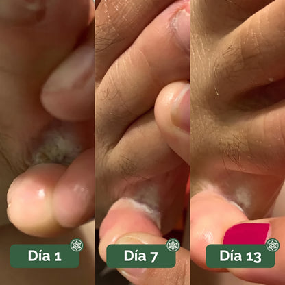 Risevelle  — Jabón de Árbol de Té para Pies | Pie seco desde la primera ducha